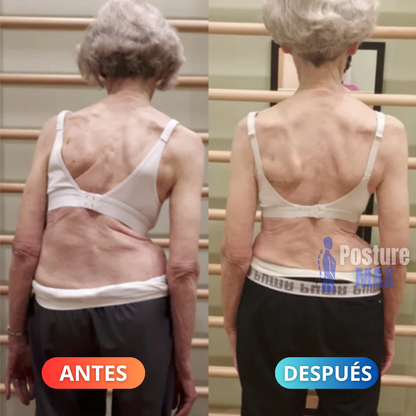 Sistema De Re-Adaptación Espinal