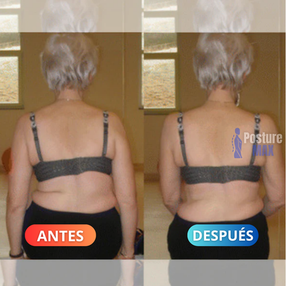 Sistema De Re-Adaptación Espinal