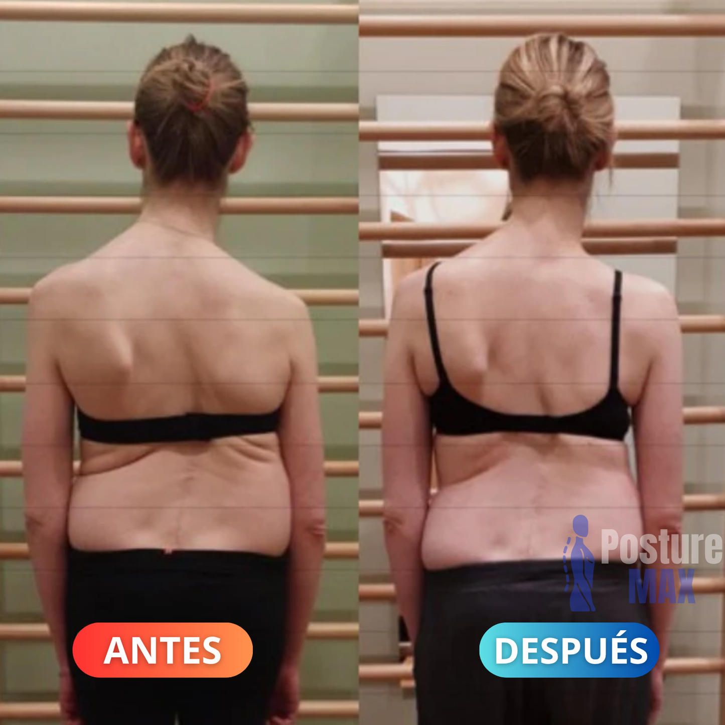 Sistema De Re-Adaptación Espinal